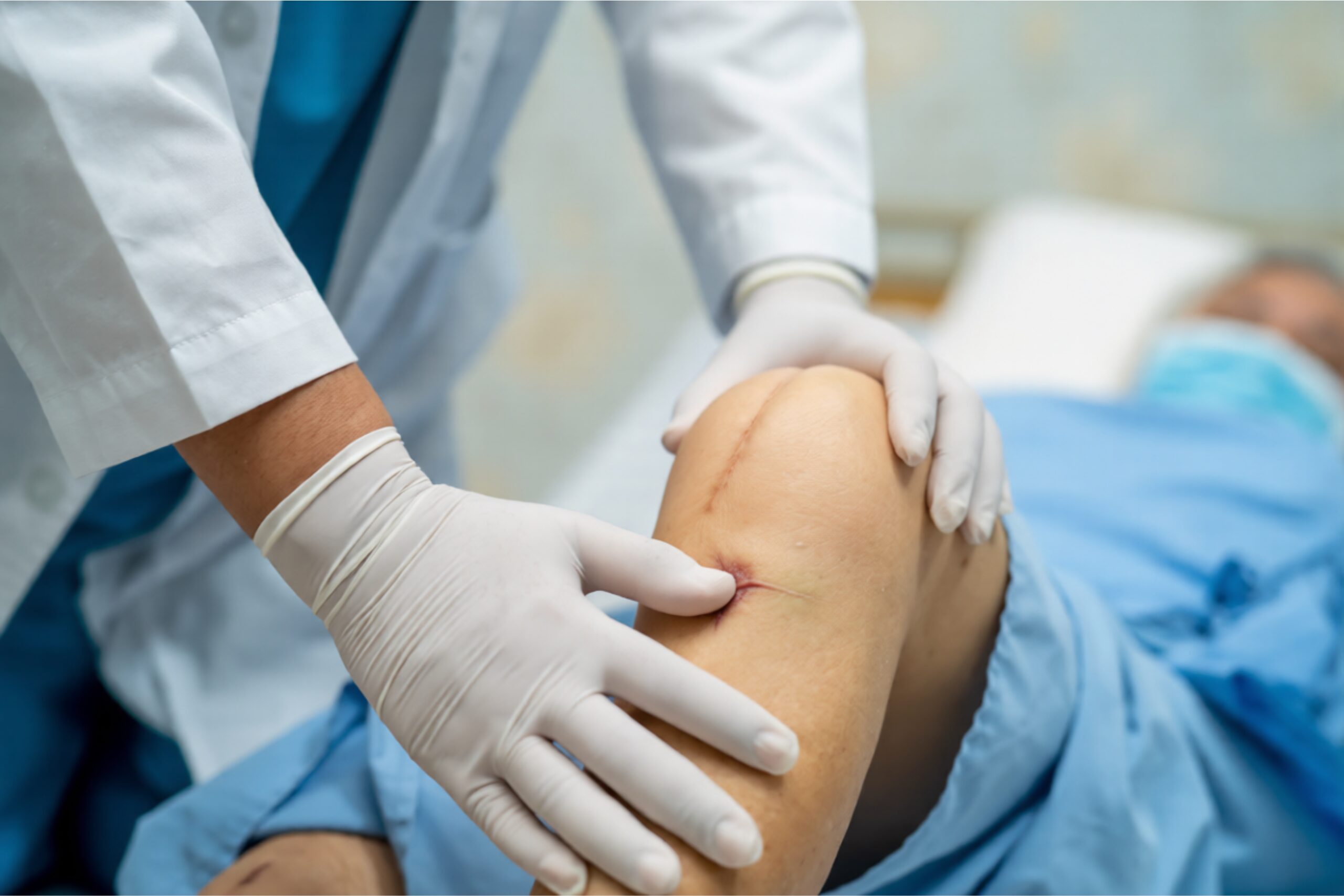 ACL Reconstruction Surgery