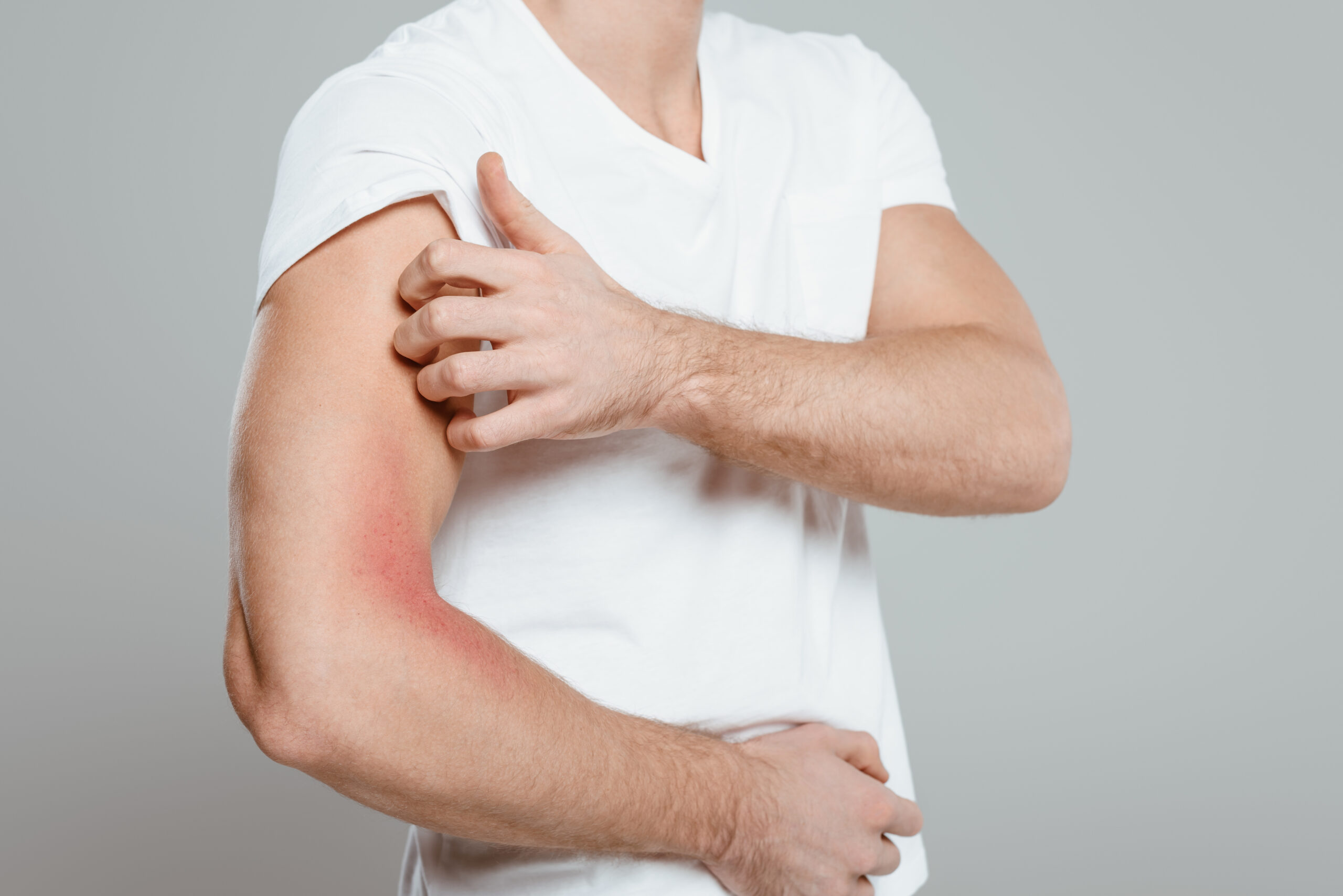 Pain in Upper Left Arm Between Elbow and Shoulder Guide